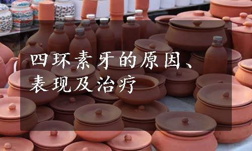 四环素牙的原因、表现及治疗