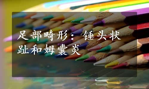足部畸形：锤头状趾和姆囊炎